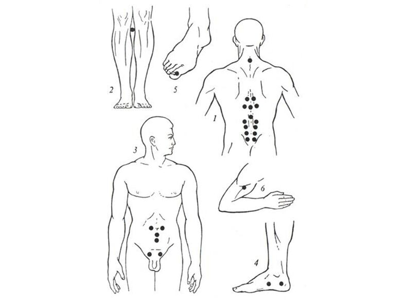Akupunkturmassage